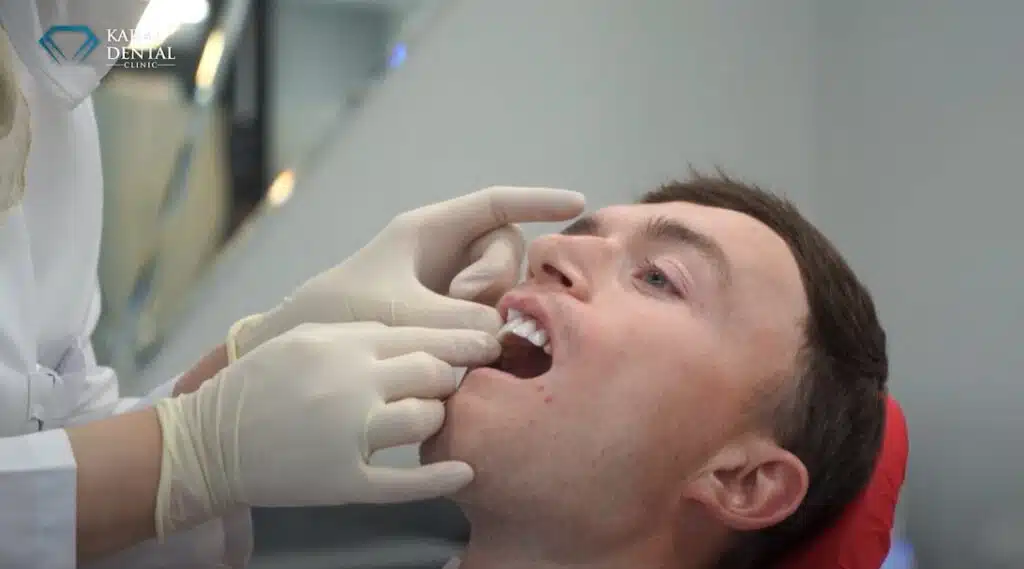 refaire ses dents en turquie