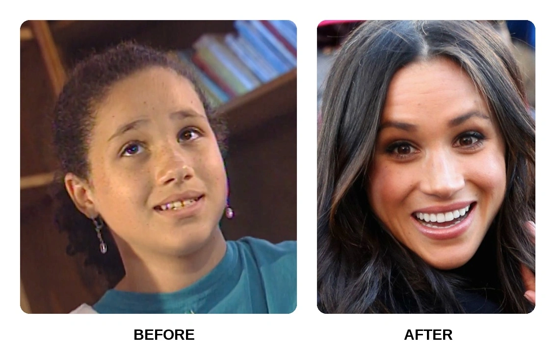 Hollywood Smile in Istanbul, Turkey