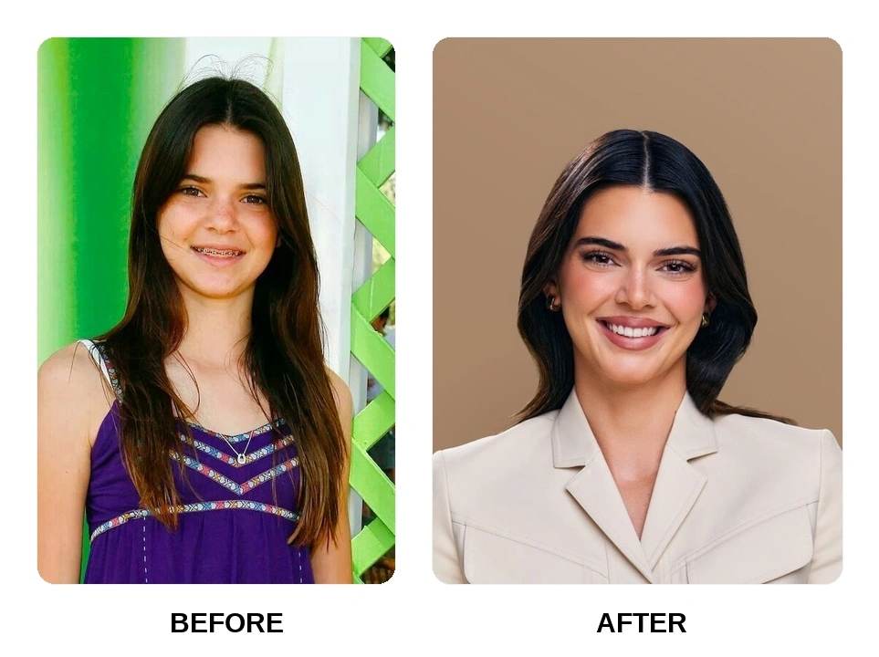 Kendall Jenner Teeth