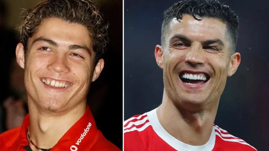 Cristiano Ronaldo Teeth Transformation