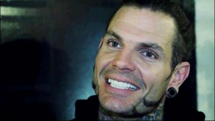 jeff hardy teeth