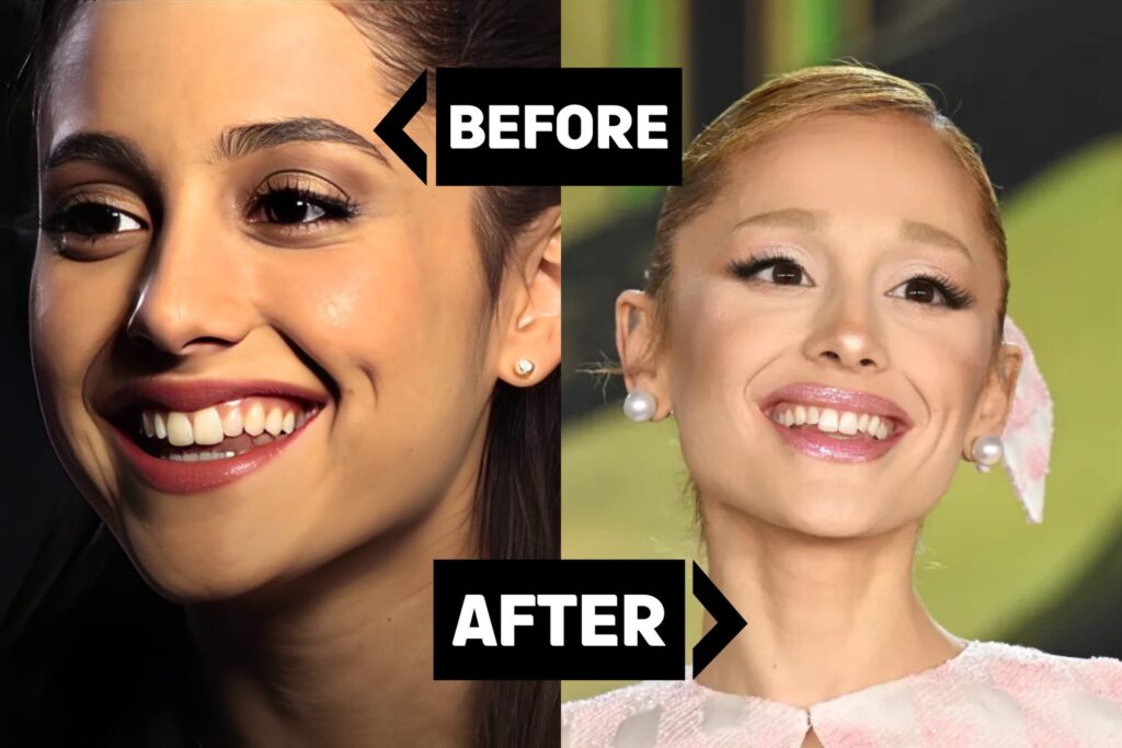ariana grande teeth