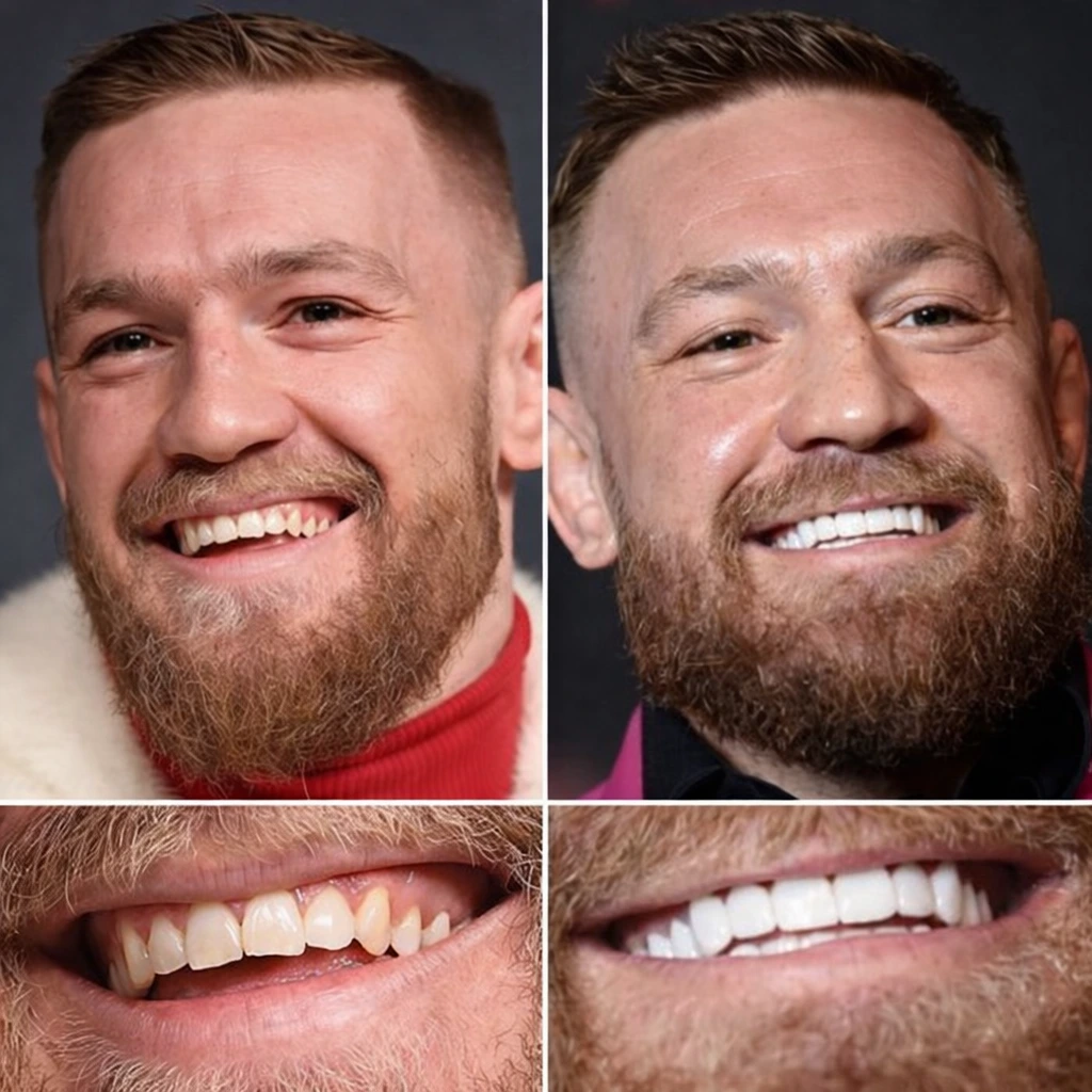Conor McGregor smile