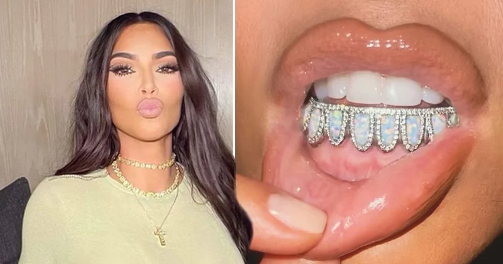 kim kardashian teeth