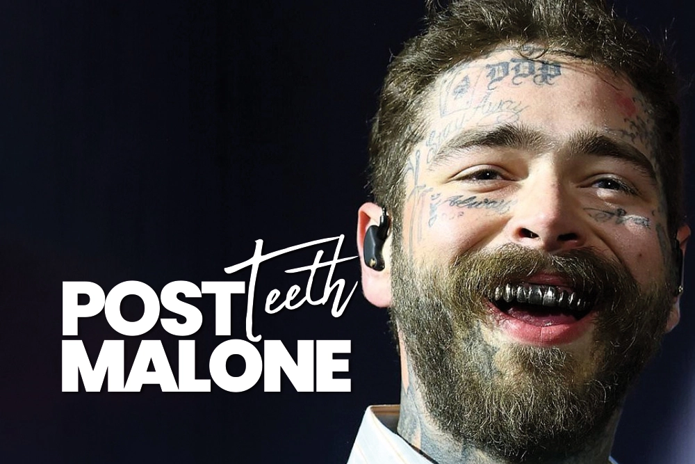 Post Malone Teeth