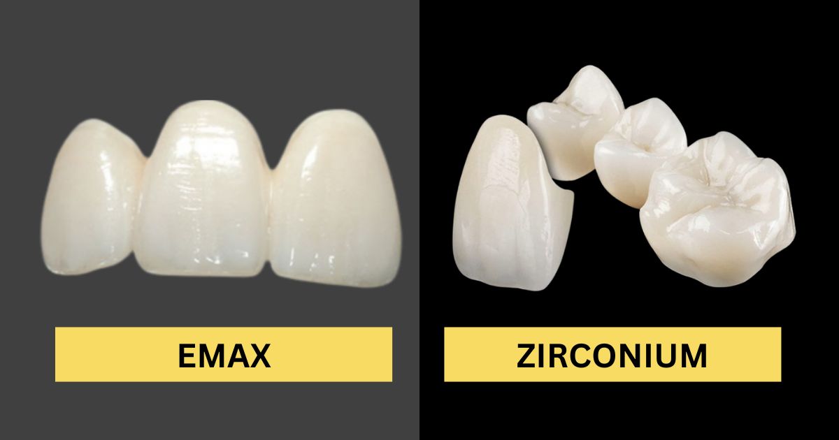 Zirconia Crown vs Emax Comparison for your smile in Turkey