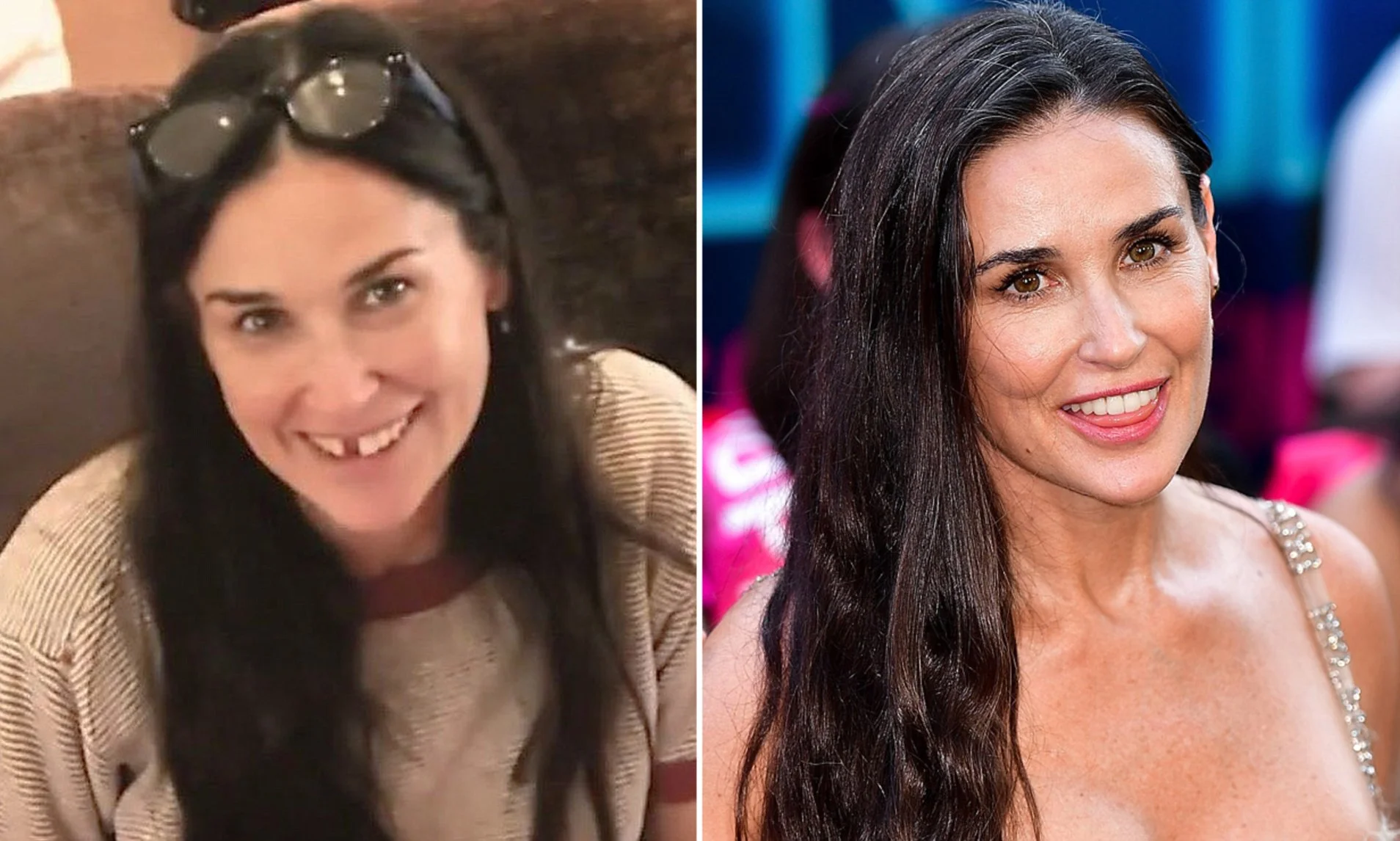 demi moore teeth before and after