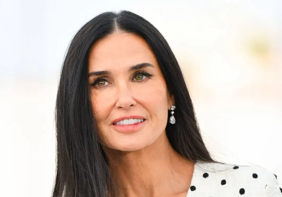 Demi Moore teeth before and after dental restoration