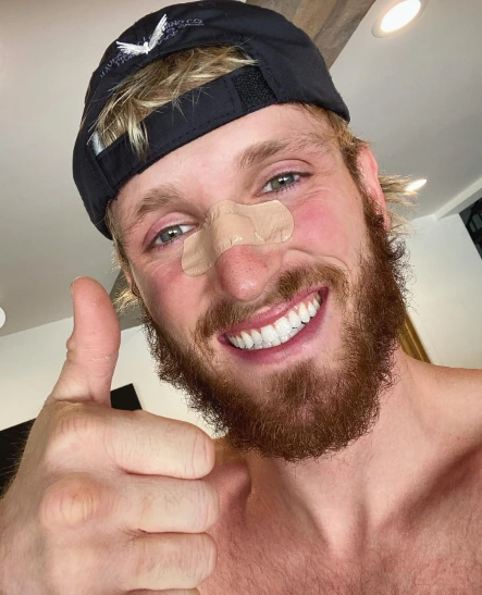 logan paul teeth