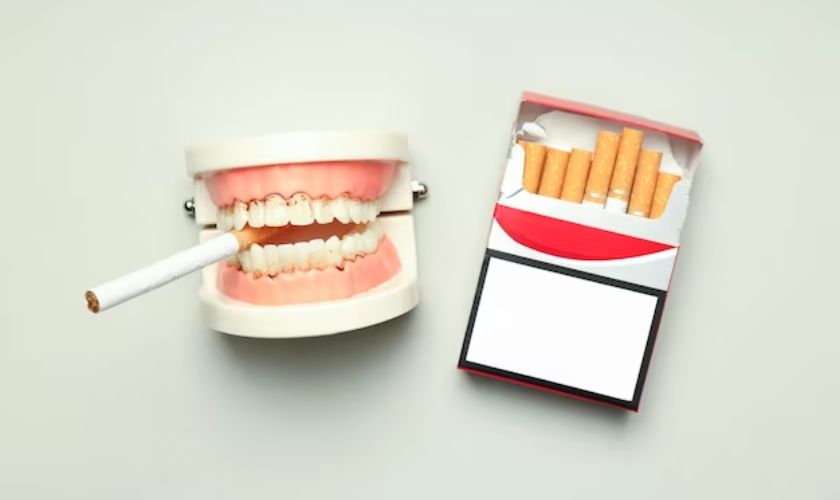 Can I Smoke After Dental Implant