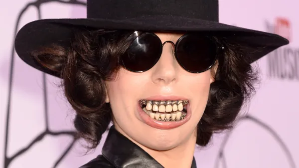 Lady Gaga Teeth: The Ultimate Review of Her Dental Transformation (2005 ...