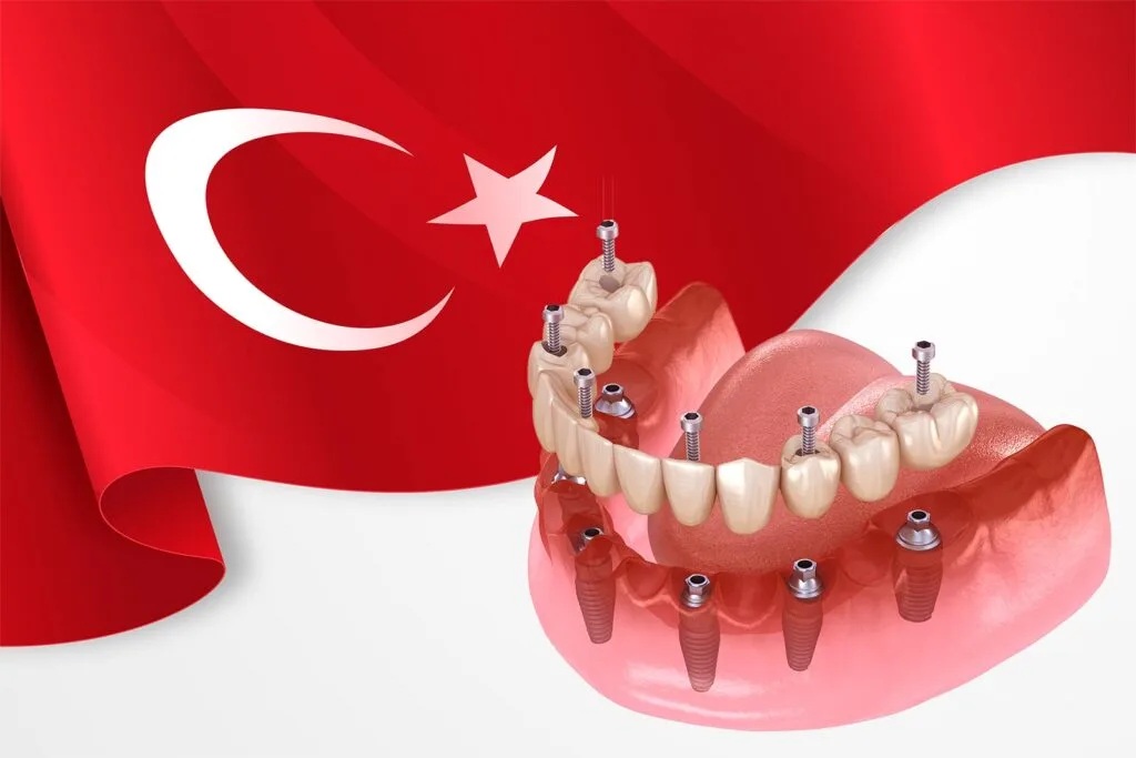 Dental Tourism Turkey