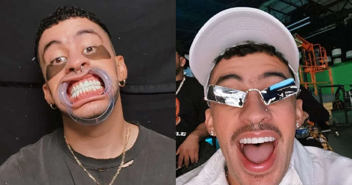Bad Bunny Teeth