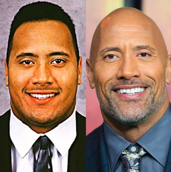 Dwayne Johnson Teeth