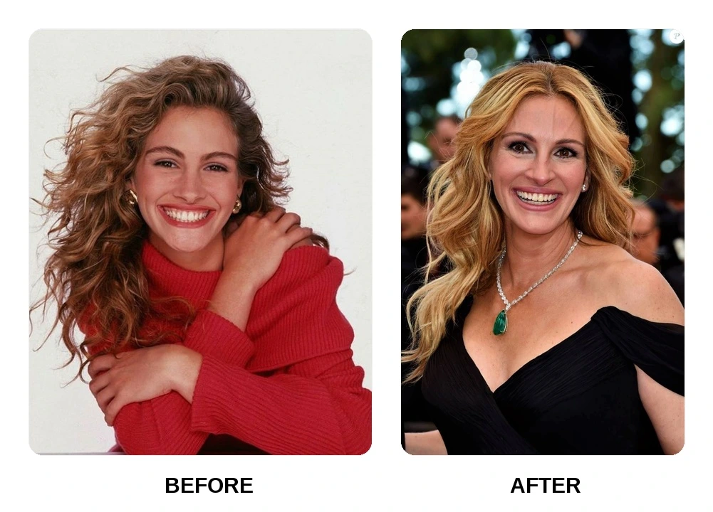 Julia Roberts Teeth