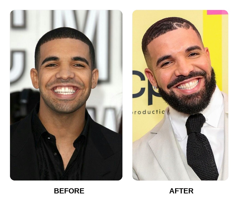 Dents de Drake