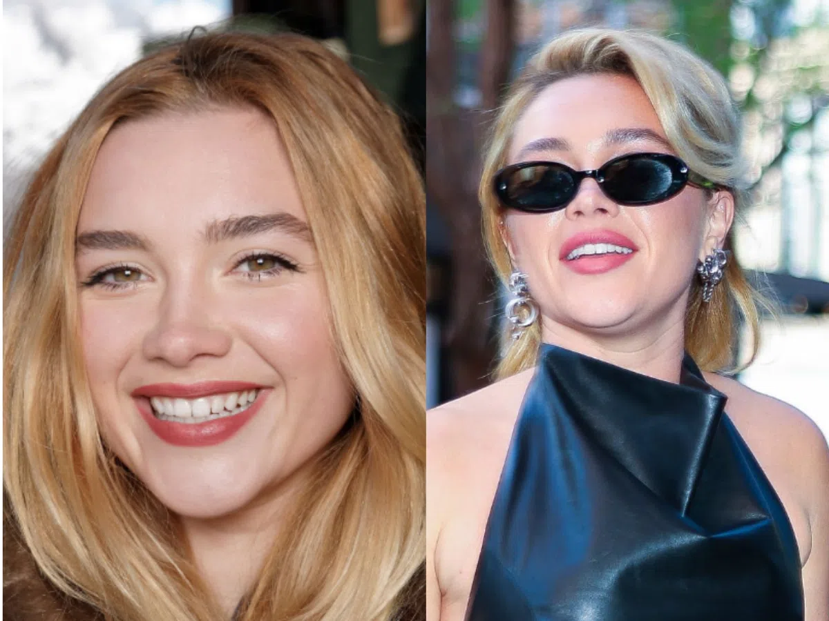 Florence Pugh Teeth