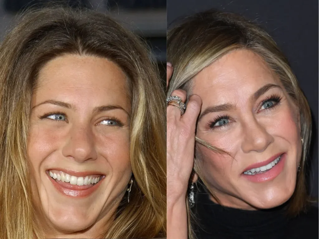 Jennifer Aniston Teeth