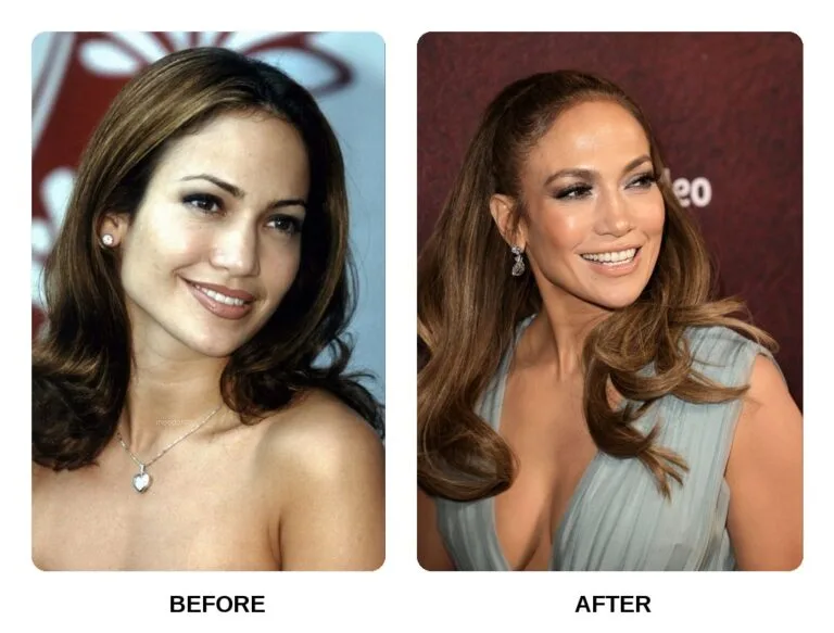 Jennifer Lopez Teeth