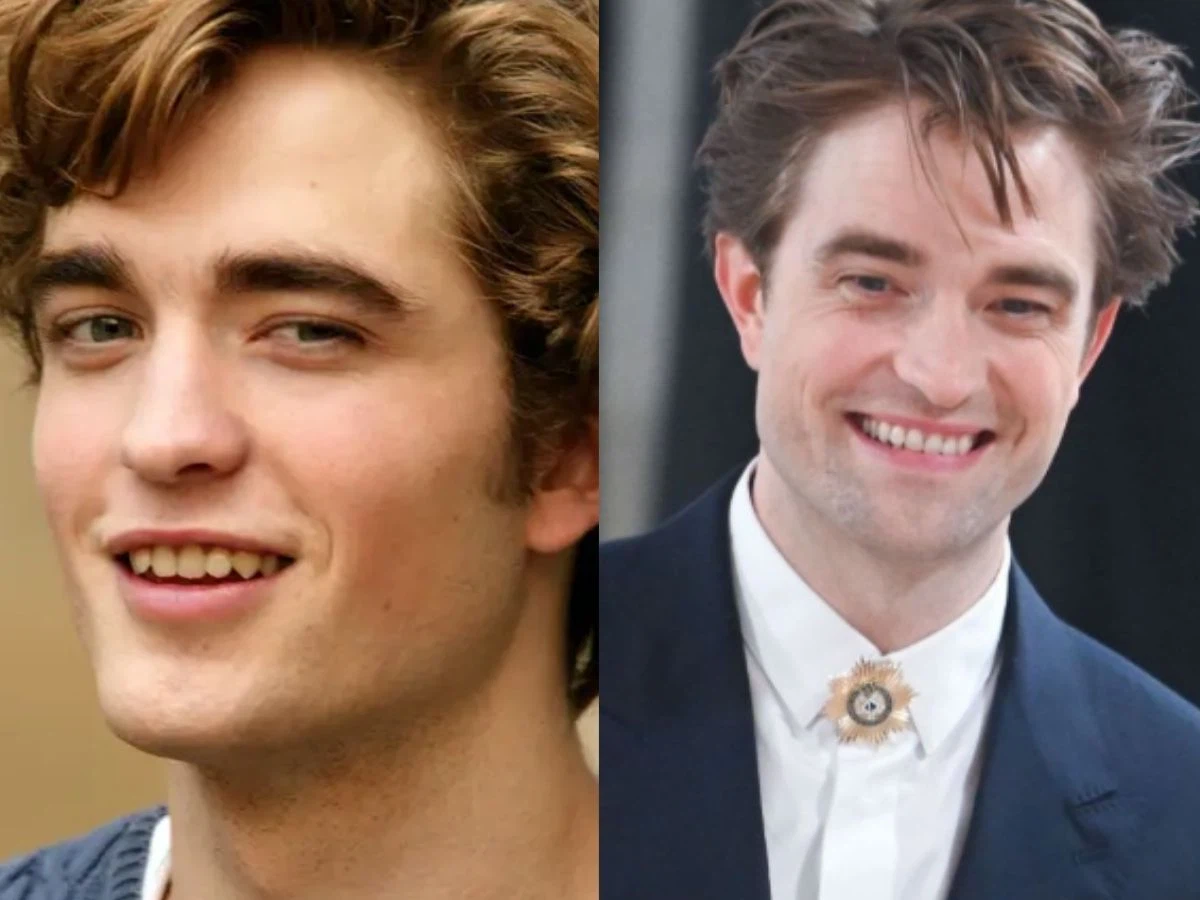Robert Pattinson teeth
