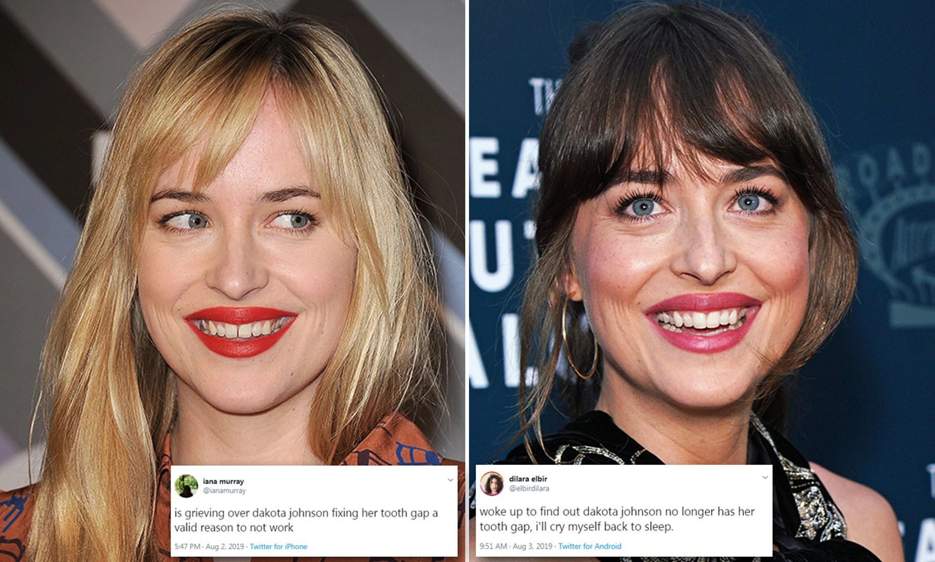 dakota johnson plastic surgery teeth before after Image 4