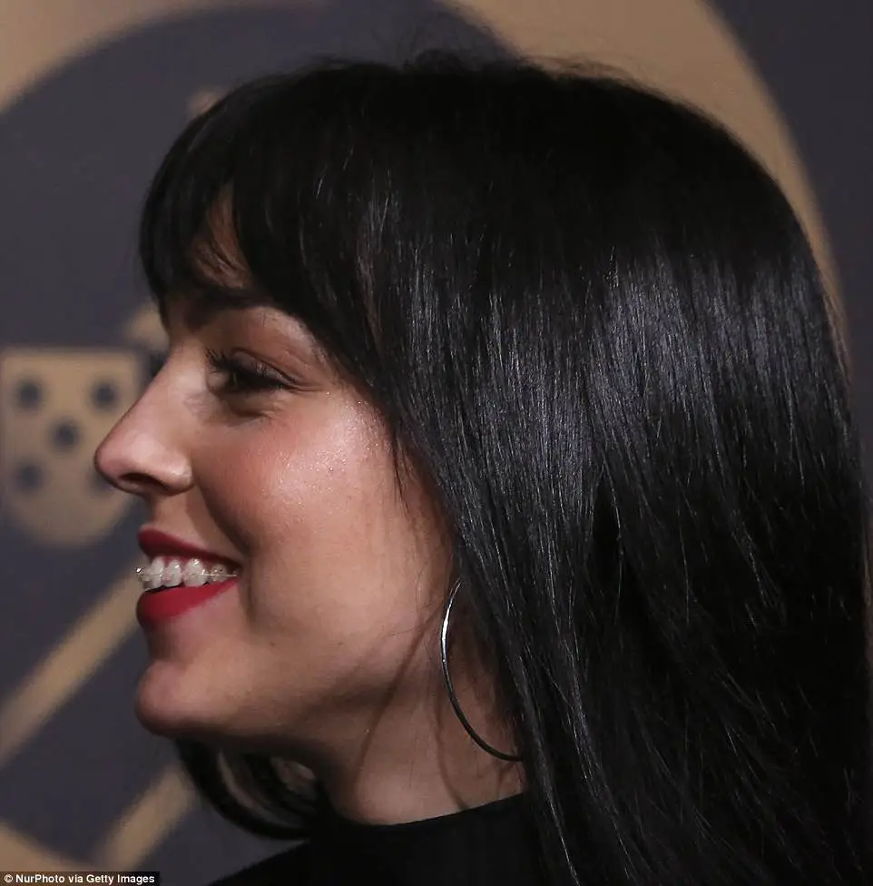 Georgina Rodríguez teeth braces era and early dental alignment