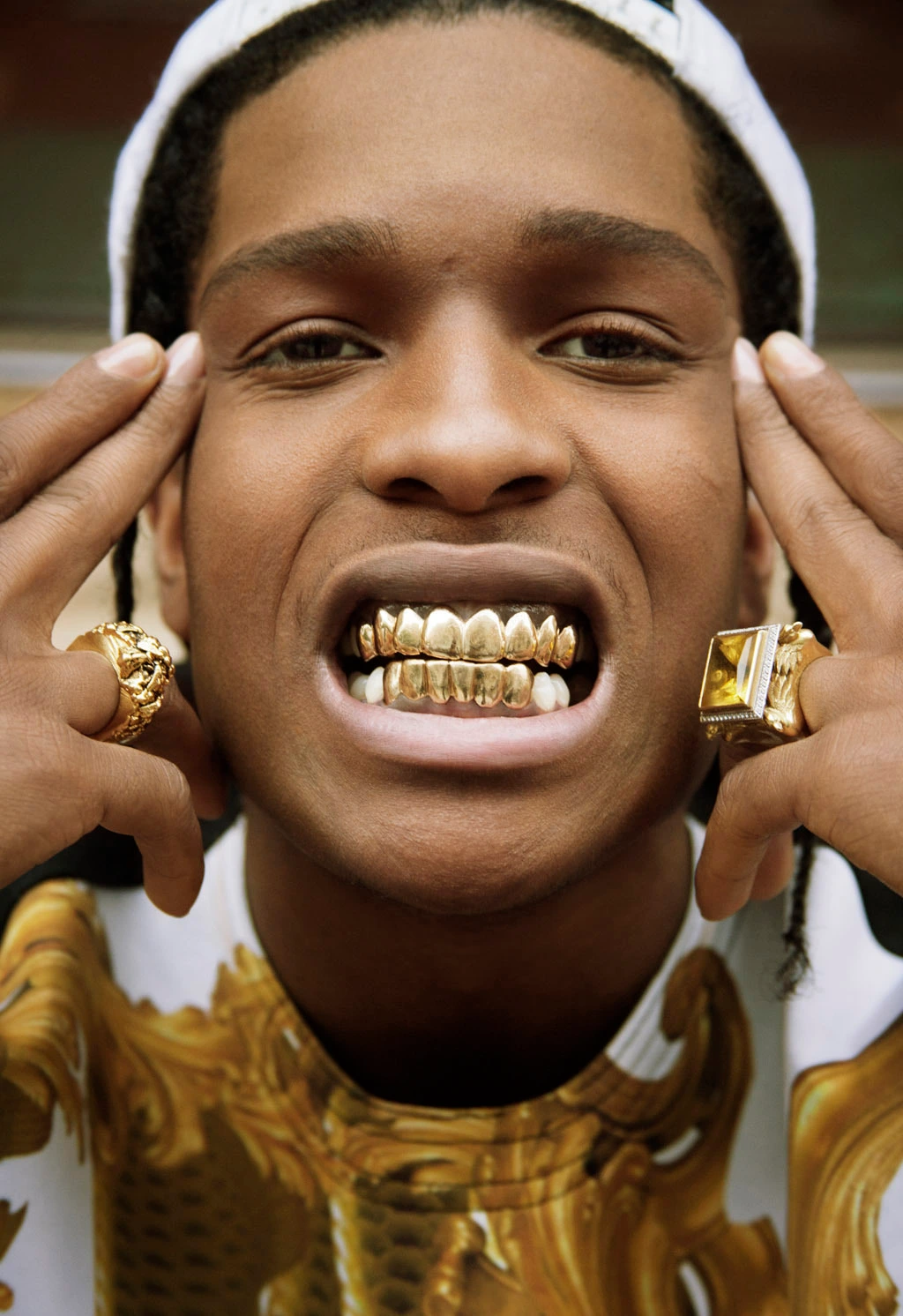 Are Gold Teeth Safe in 2026? Permanent Crowns vs. Grills Guide