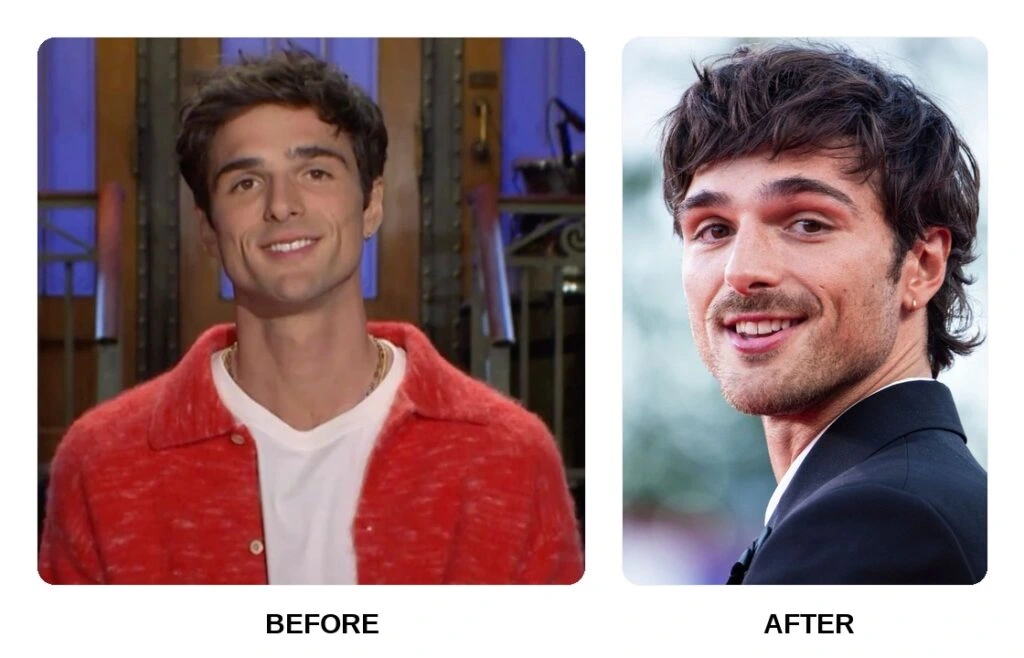 Jacob Elordi Teeth