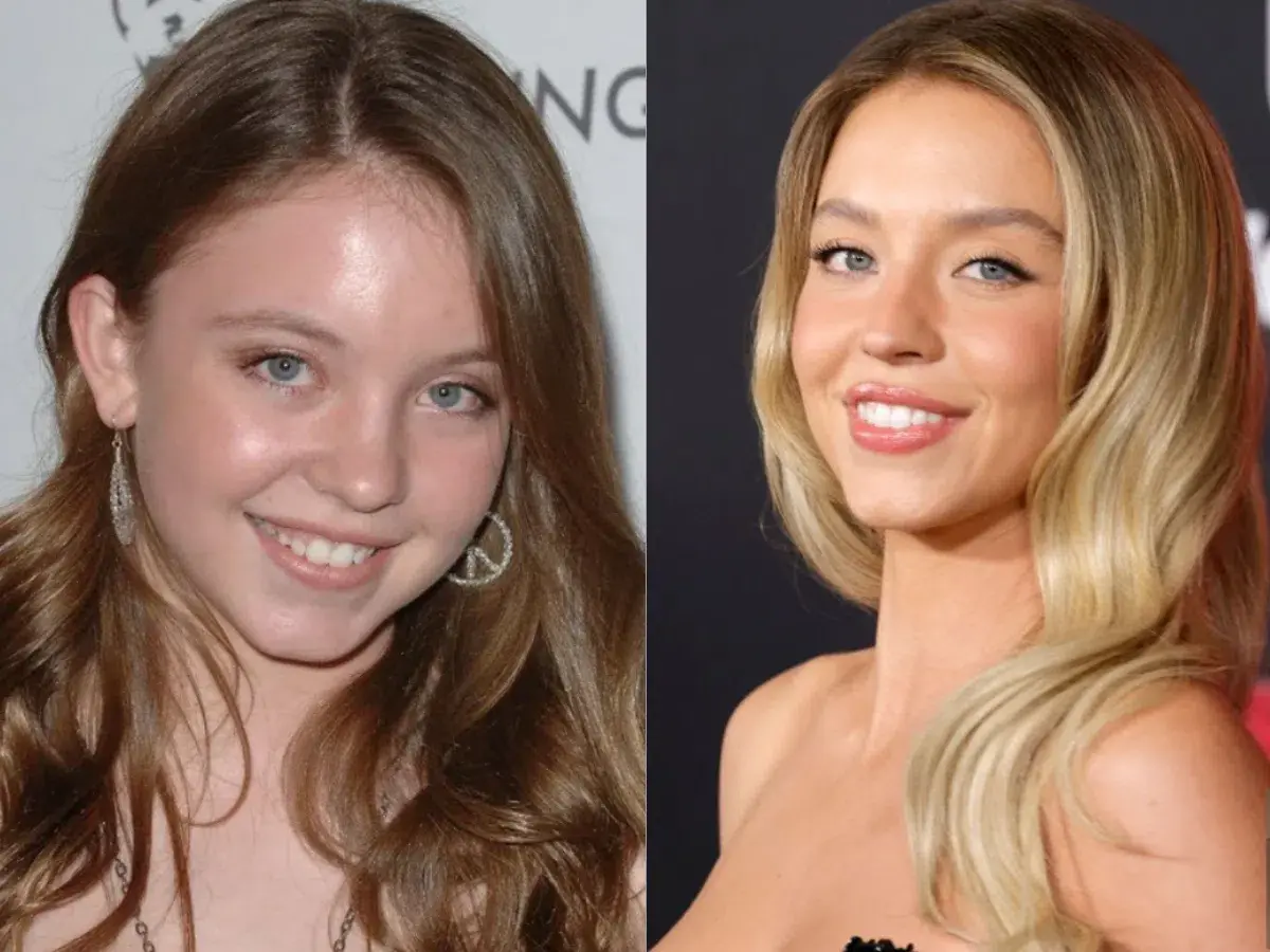 Sydney Sweeney Teeth