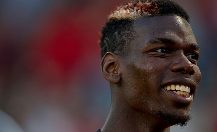 Mpaulf Pog Paul Pogba Teeth Before and After 2026: The Secrets of His Dental ...