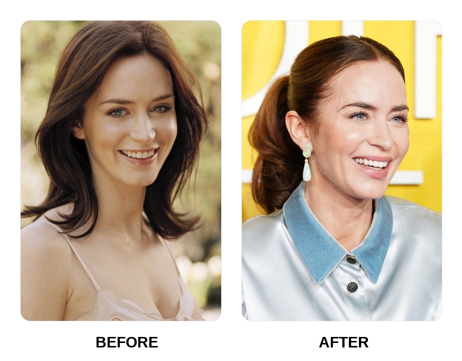 Emily Blunt teeth
