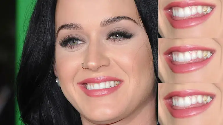 Katy Perry Teeth