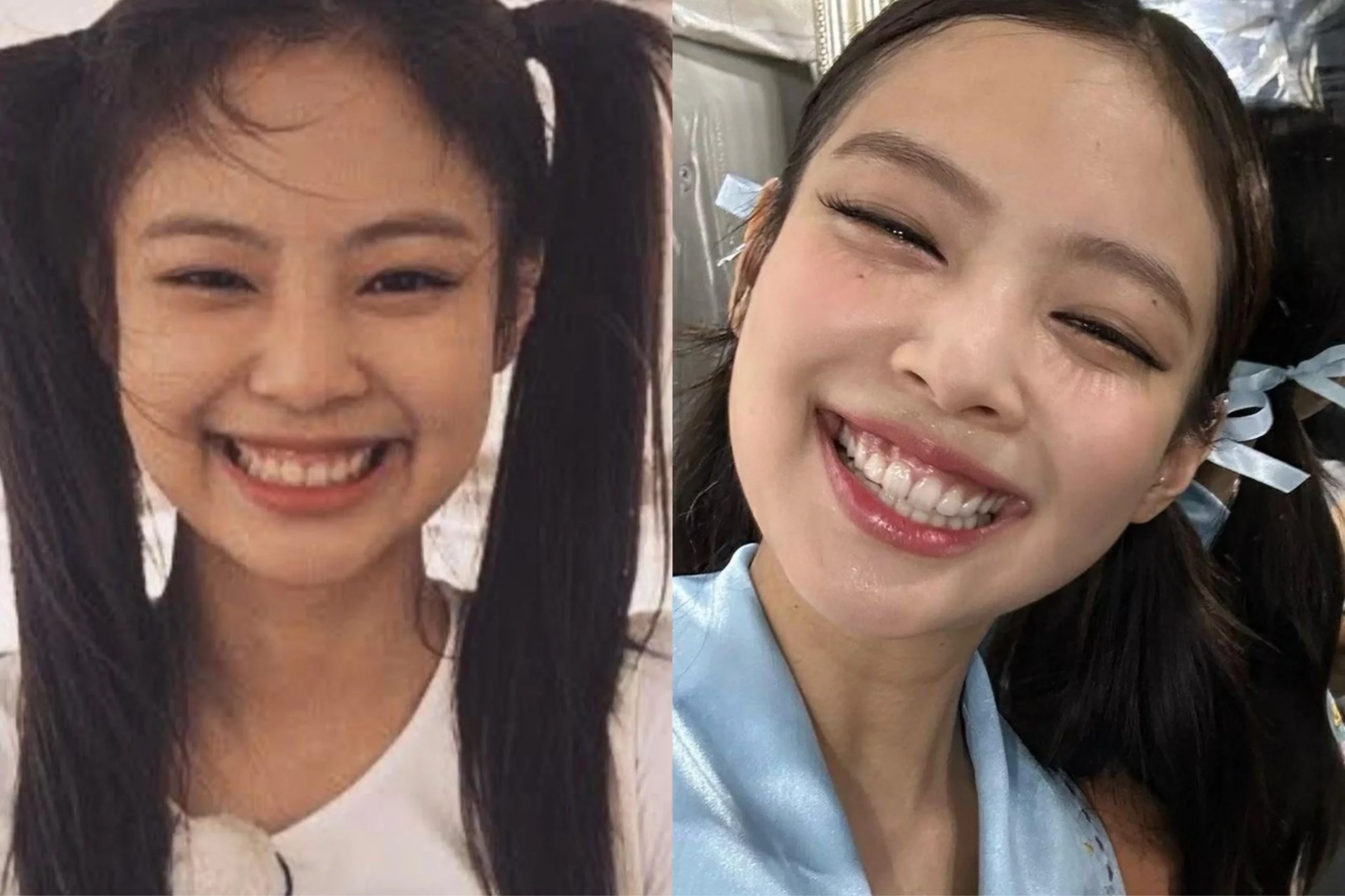 Jennie Blackpink teeth