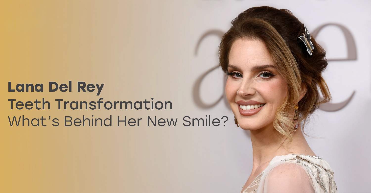 Lana Del Rey Teeth