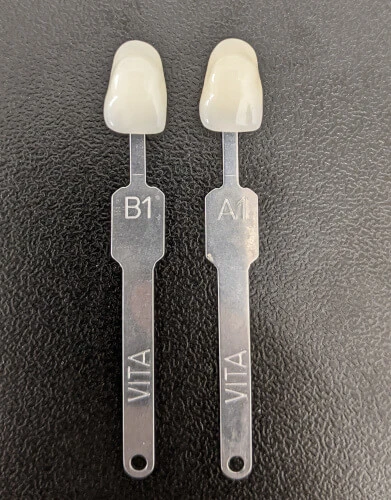 Visual comparison showing the delicate differences between A1 vs B1 tooth color tabs