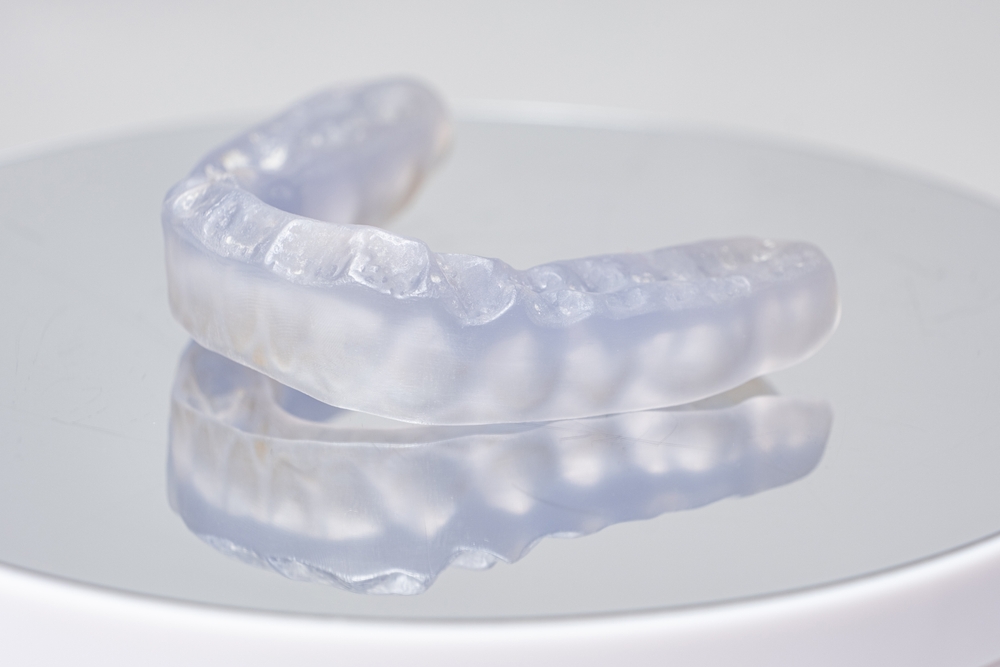 Une gouttière de nuit sur mesure en acrylique dur transparent de haute qualité placée sur un modèle en plâtre dentaire