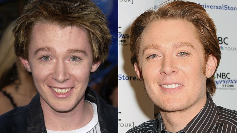 Clay Aiken Teeth