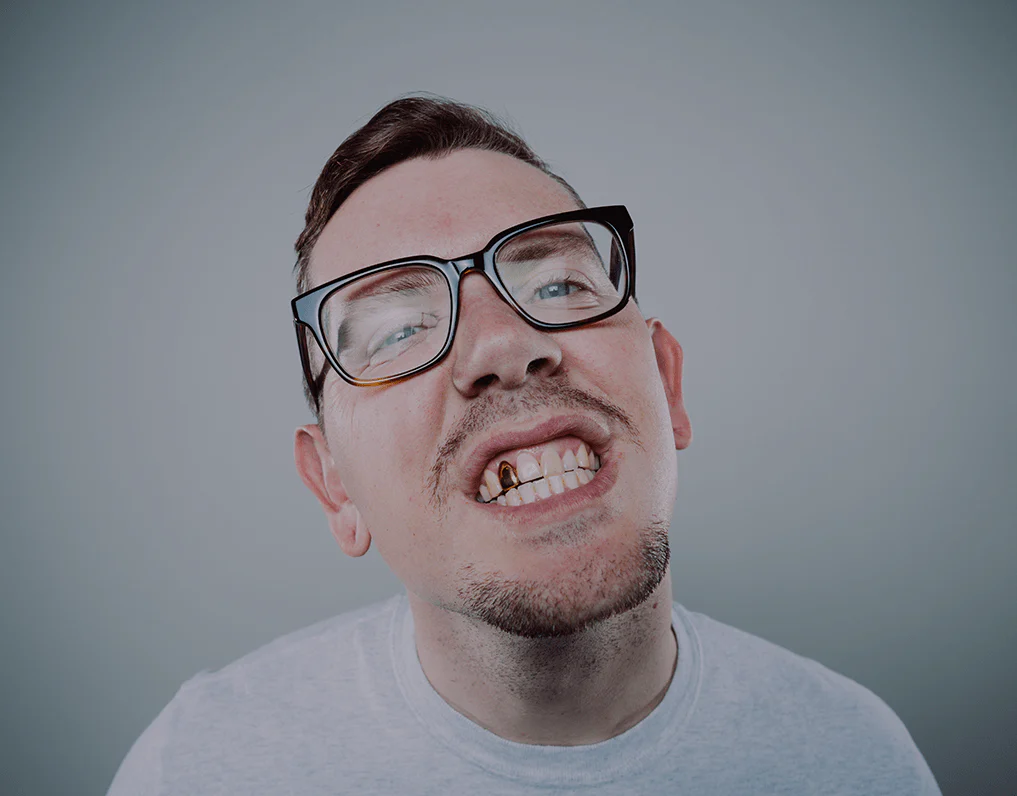 Detailed clinical breakdown of gold dental crown cost facts pros and cons for restorative dentistry