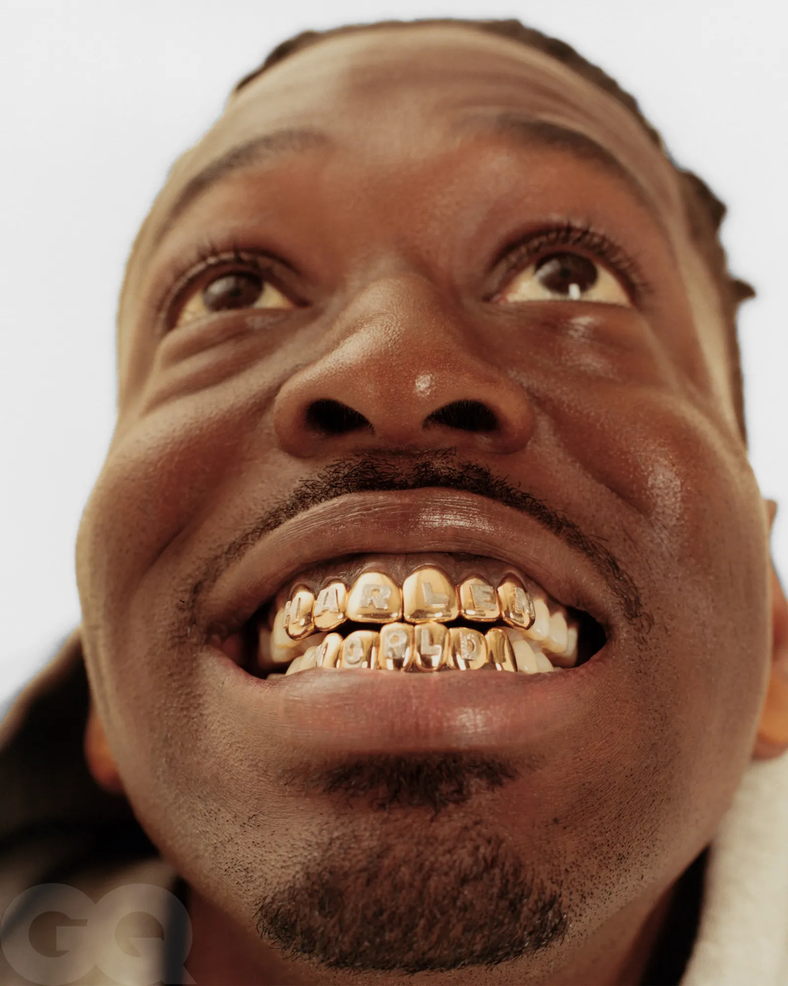 A high-fashion close up of premium custom gold dental grills representing modern urban luxury and pop culture trends