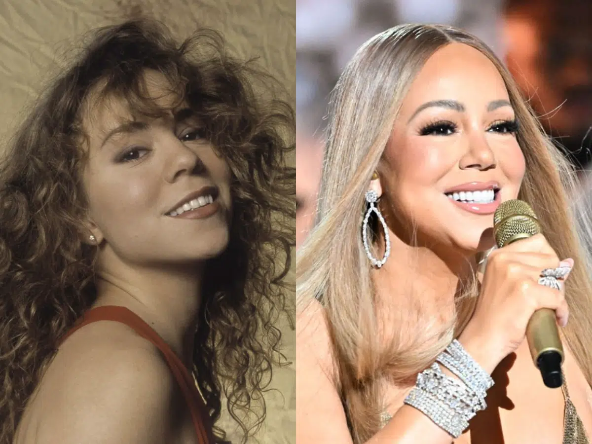 Mariah Carey teeth