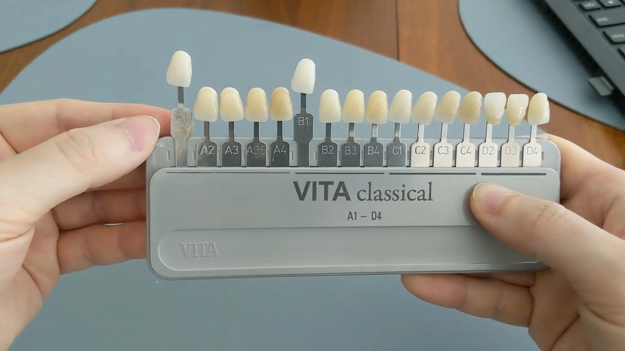 A comprehensive clinical analysis of A1 vs. B1: The Traditional Brightness Battle in cosmetic dentistry shade guides