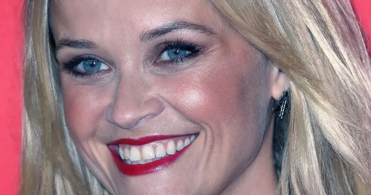 Esthetique dentaire professionnelle de Reese Witherspoon et evolution des dents blanches