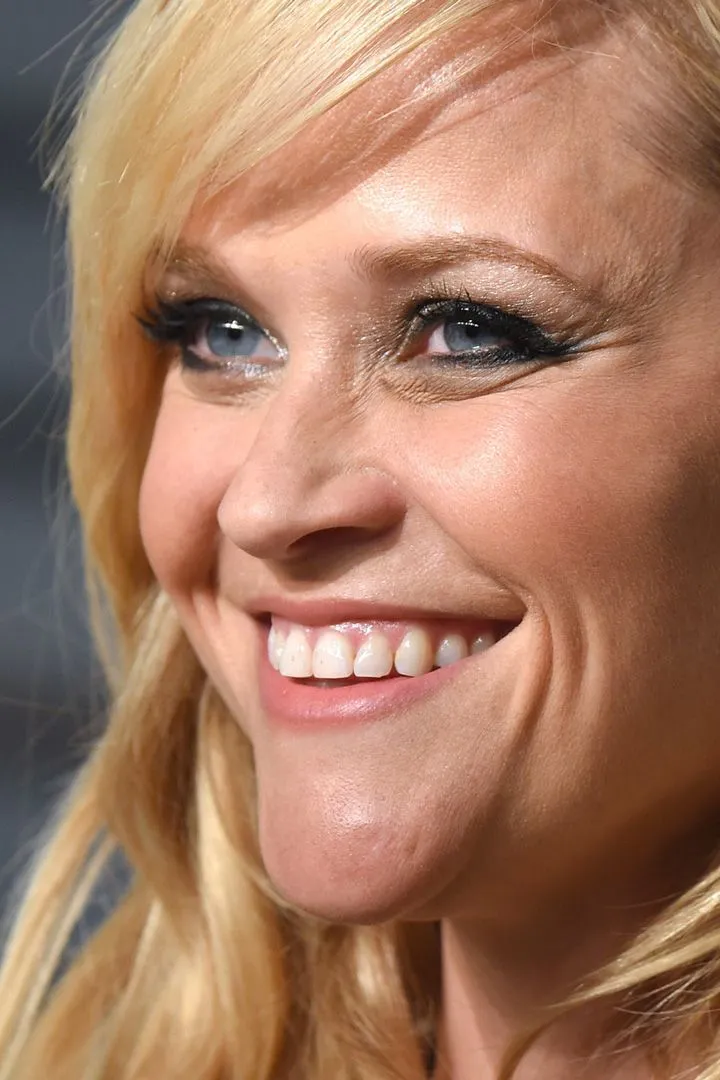 Transformation du sourire de Reese Witherspoon pour Elizabeth Arden et facettes d aspect naturel