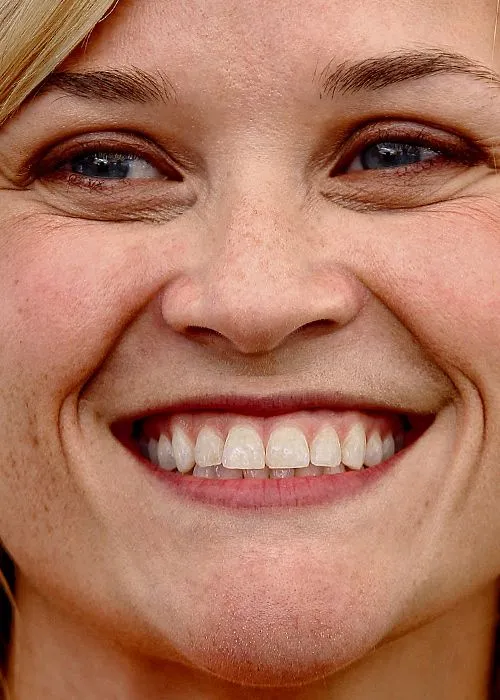 Reese Witherspoon souriant avec une harmonie dentaire parfaite et des gencives saines