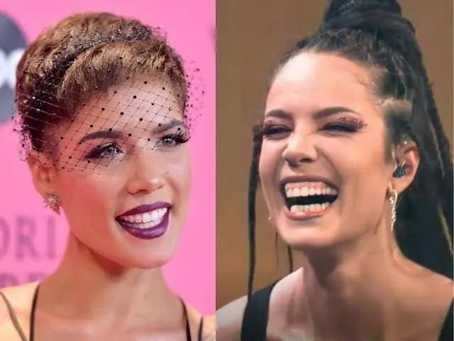 Halsey Teeth