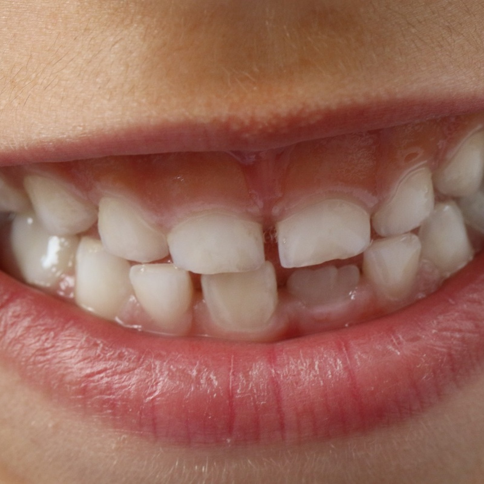 Japanese pharmaceutical startup tooth regrowth drug timeline