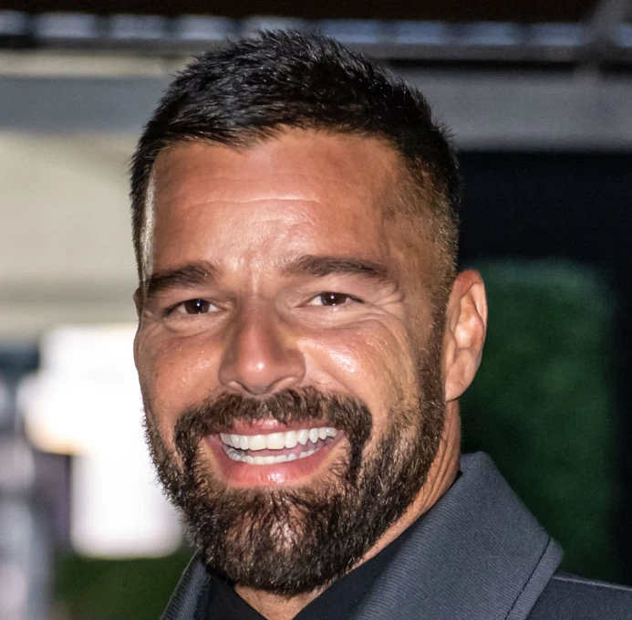 Les dents de Ricky Martin en 2026 esthetique hollywood smile haut de gamme