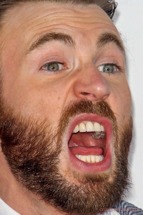 Chris Evans souriant en 2015 mettant en valeur son arcade dentaire large et équilibrée