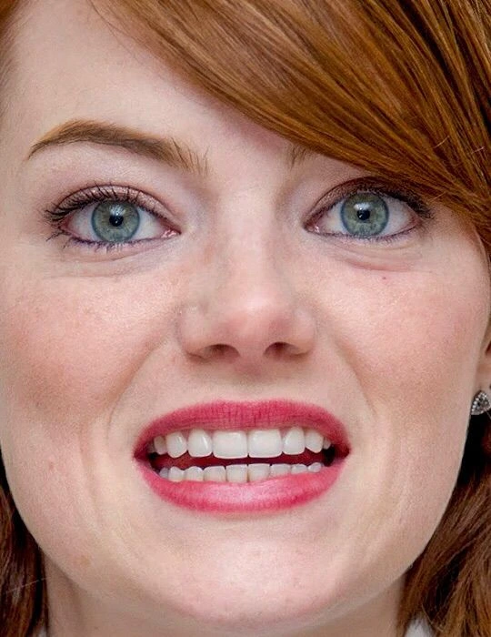 Dents d Emma Stone en 2020 montrant un alignement et un blanchiment affines