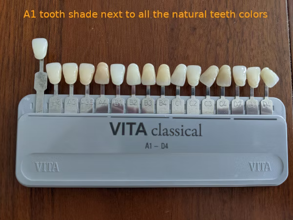 A1 vs A3 teeth color comparison chart showing the differences between bright white and natural warm shade